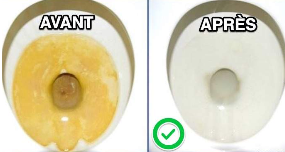 Le Truc Efficace Pour Nettoyer Le Fond De La Cuvette ENCRASSÉ.